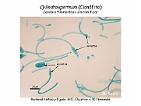 11 AtlasAlgasMicroscopicas Cylindrospermum-2