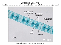 51 AtlasAlgasMicroscopicas Zygnema