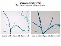 57 AtlasAlgasMicroscopicas Cladophora-1