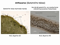 AtlasBriofitos 72 Anthoceros Gametofito Rizoides SeccionMicrocopica Cianobacterias