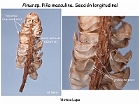 AtlasGimnospermas 7 Pinus cono masculino lupa seccion