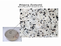 Atlas Hongos 02 Rhizopus zygomiceto