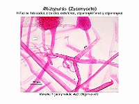 Atlas Hongos 07 Rhizopus zygomiceto